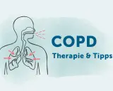 Illustration zeigt Lunge und Atemwege. Rote Pfeile deuten auf die Lunge. Text: COPD Therapie & Tipps. Wichtige Infos zu COPD Medikamente.