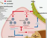 Das Diagramm zeigt, wie sich das Zahnfleisch nach Rauchstopp regeneriert. Es erklärt die Rolle von Monozyten und Neutrophilen bei Entzündung und Reparatur.