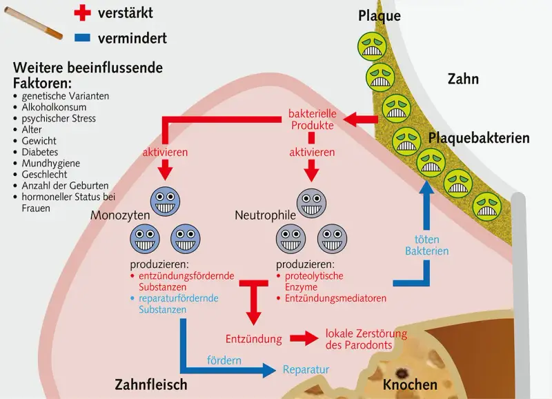 Das Diagramm zeigt, wie sich das Zahnfleisch nach Rauchstopp regeneriert. Es erklärt die Rolle von Monozyten und Neutrophilen bei Entzündung und Reparatur.